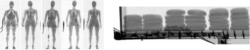 X-ray